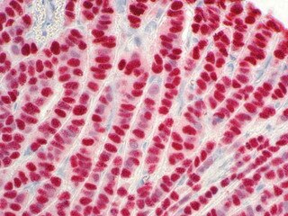 IHC of Estrogen Receptor on a FFPE Breast Tissue